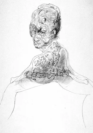 Lithographie Bellmer - La morte