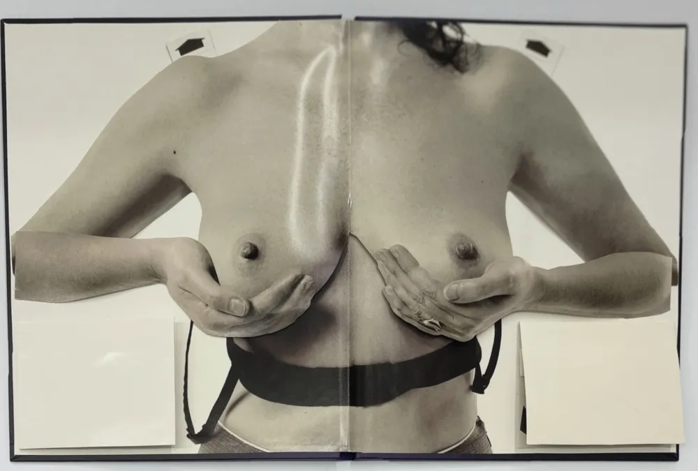 Photographie Calle - Les seins miraculeux (Beautiful breasts)