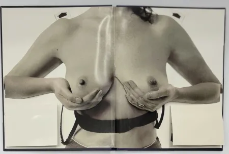 Photographie Calle - Les seins miraculeux (Beautiful breasts)