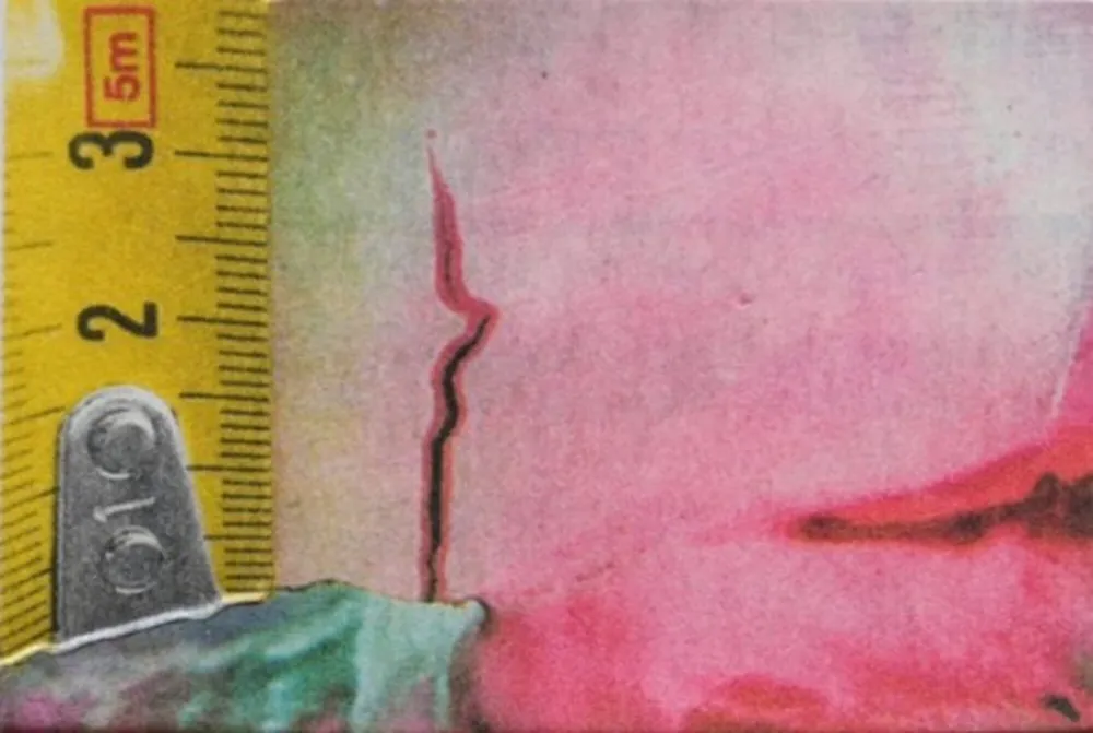 Photographie Mcbride - Untitled (Rulers II)